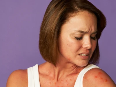 Mulher com uma irritação na pele