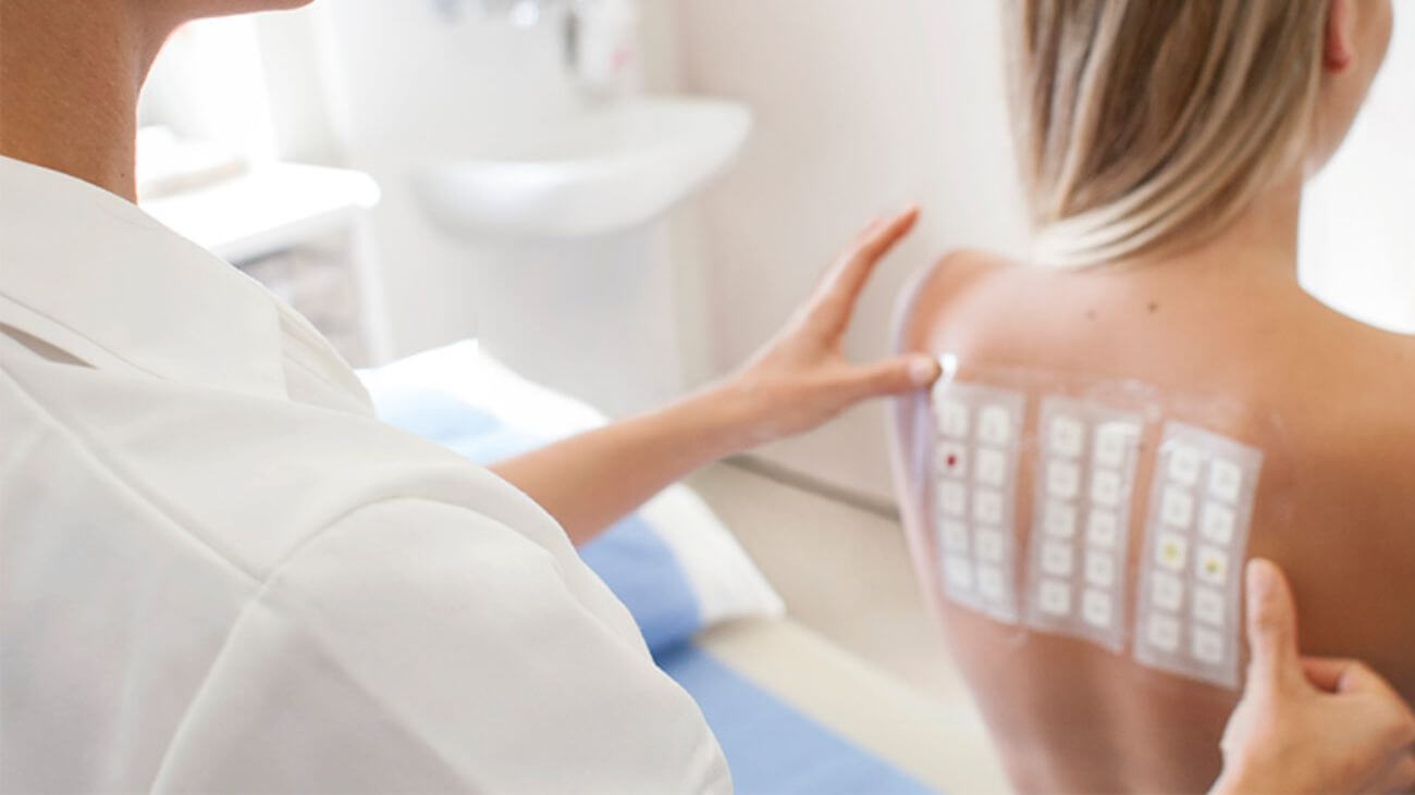 How To Prepare for Allergy Testing | Allegra